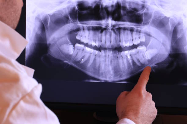 Best Emergency Root Canal Treatment in East Hills, NY