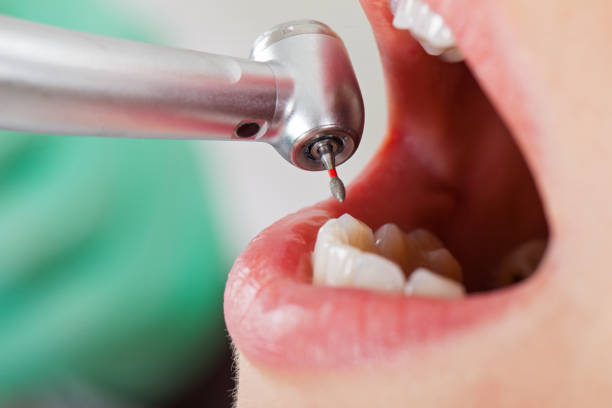 Best Emergency Treatment for Toothache in East Hills, NY